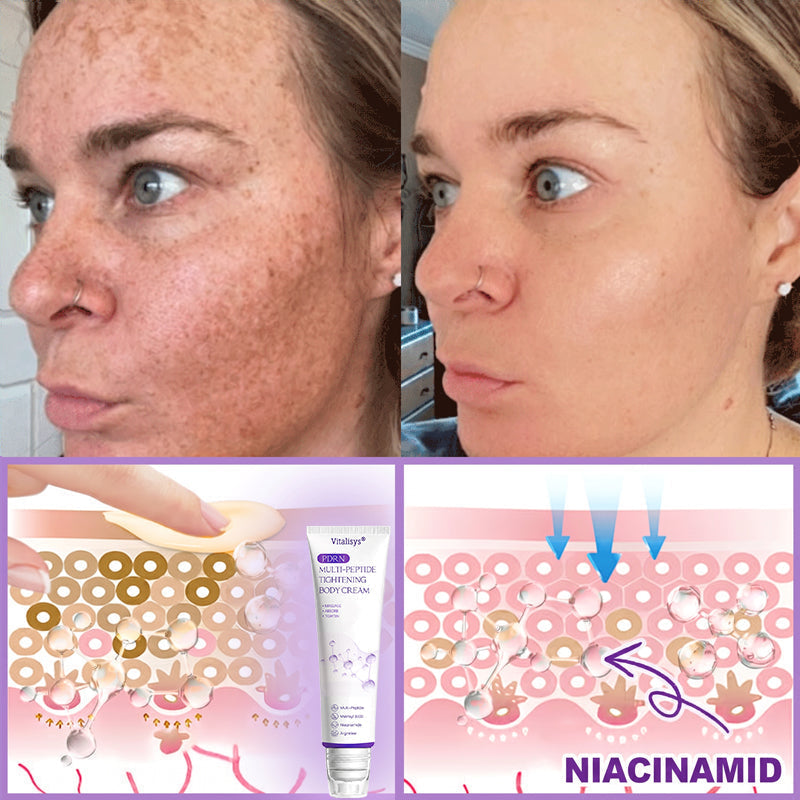 Vitalisys® 🍅PDRN Multi-Peptide Massaging Body Roller Cream- Anti-aging, Hydrating, Skin Firming & Lifting, Skin Repair, Even Tone, Acne and Dark Spot Treatment, Wart and Mole Removal, and Psoriasis Relief.