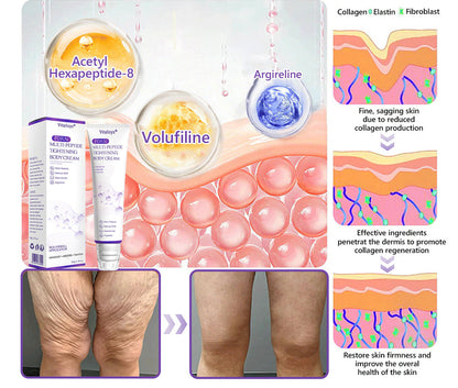 Vitalisys® 🍅PDRN Multi-Peptide Massaging Body Roller Cream- Anti-aging, Hydrating, Skin Firming & Lifting, Skin Repair, Even Tone, Acne and Dark Spot Treatment, Wart and Mole Removal, and Psoriasis Relief.