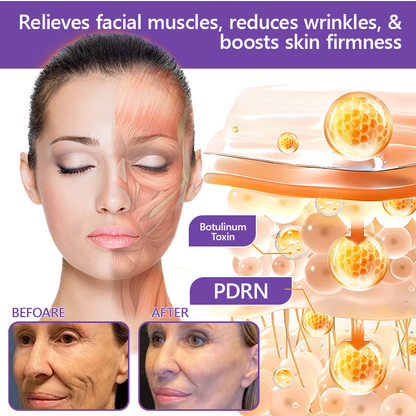 Vitalisys® 🍅PDRN Multi-Peptide Massaging Body Roller Cream- Anti-aging, Hydrating, Skin Firming & Lifting, Skin Repair, Even Tone, Acne and Dark Spot Treatment, Wart and Mole Removal, and Psoriasis Relief.