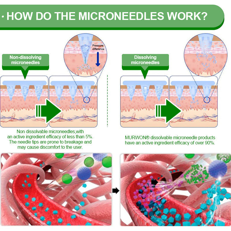 GMP Standard & Licensed for Quality🥕| 𝑴𝙐𝗥𝓦𝐎𝙉® 𝑩𝒆𝒓𝑏𝘦𝘳𝑖𝗇𝒆 10-𝗶𝙣-𝟏 𝑁𝑎𝑛𝑜 𝘔𝘪𝘤𝘳𝘰𝘯𝘦𝘦𝘥𝘭𝘦 𝖯𝚊𝗍𝖼𝗁 |𝘉𝘢𝘤𝘬𝘦𝘥 𝘣𝘺 𝘴𝘤𝘪𝘦𝘯𝘤𝘦 | 10-𝗂𝗇-𝟣 𝖿𝗈𝗋𝗆𝗎𝗅𝖺 | 𝑅𝑒𝑠𝑢𝑙𝑡𝑠 𝑖𝑛 7 𝑑𝑎𝑦𝑠
