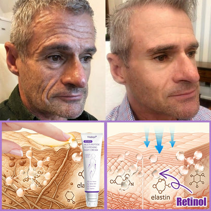 Vitalisys® 🍅PDRN Multi-Peptide Massaging Body Roller Cream- Anti-aging, Hydrating, Skin Firming & Lifting, Skin Repair, Even Tone, Acne and Dark Spot Treatment, Wart and Mole Removal, and Psoriasis Relief.